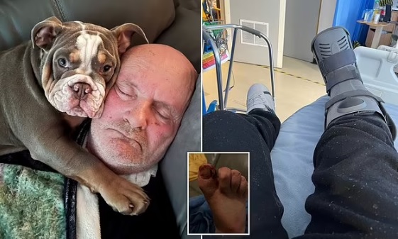 தூங்கும் போது கால் விரலைக் கடித்து தின்ற நாய்- ஆனால் அதனால் தான் அவர் உயிர் பிழைத்தாராம்